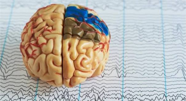 Morte cerebral: tudo que você precisa saber sobre o assunto! - Grupo  Biocentro