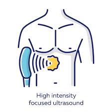 Focused Ultrasound: 60,000+ patients ...