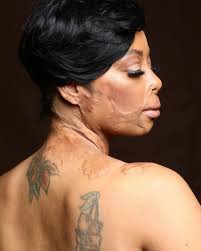 When God gives Beauty for Ashes. Attacked with Acid 2018 and still fighting  this case look at me now. God and time heals. I can't thank God enough for  keeping me. I've