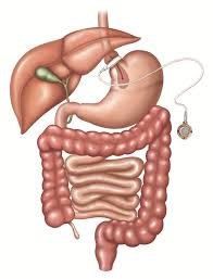How much does an adjustable gastric band surgery cost?on mdsave, the cost of an adjustable gastric band surgery ranges from $10,725 to $19,250. Bariatric Surgery The Challenges With Candidate Selection Individualizing Treatment And Clinical Outcomes Bmc Medicine Full Text