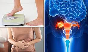 In advanced stages of ovarian cancer, patients may experience gastrointestinal and other digestive disorders, with symptoms such as nausea, vomiting and diarrhea. Cancer Symptoms Ovarian Signs Of Tumour Revealed Including Weight Loss And Bloating Express Co Uk