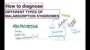 1 Minute Medicine How Does Crohn Disease Increase The Risk Of Calcium Oxalate Kidney Stones Usmle Youtube