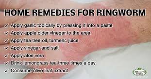 Compared to the commercially available soaps and face washes that are loaded with chemicals and preservatives, vinegar is a natural and safer way. Ringworm Tinea Is A Fungal Infection Of The Skin Which Is Highly Contagious Belmarra Ringwormhealth Home Remedies For Ringworm Ringworm Remedies Ringworm