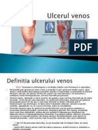 Presiunea ar trebui sa imbunatateasca circulatia picioarelor, grabind vindecarea. Ulcerul Venos