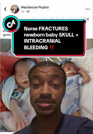 Nurse Accused of Fracturing Newborn's Skull: What Happened?