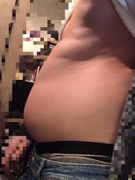 Naja, ein paar kilos zu viel vielleicht. Bin Ich Ubergewichtig 13 Jahre 75kg Ubergewicht Fett Zunehmen