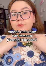 Hannah Laser