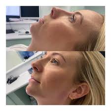 Dr Sillett Aesthetics added a new...