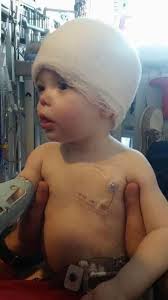 Charley was like “what major brain surgery? I'm ready to play.”