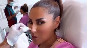 Mädels, heute ist eure nacht! Senna Gammour Botox Gestandnis