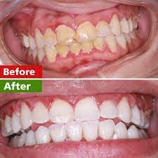 Pin On Dental Facts