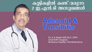 The top rated ent specialists in los angeles are: Adenoid Tonsillitis In Children Dr K A Seethi Chief Ent Surgeon Moulana Hospital Youtube