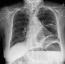Pin On Radiology For Clinicians