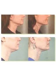 Medical tourism in malaysia malaysia is a relatively modern country that is becoming incredibly popular for medical tourism. Plastic Surgery Clinics In Bangsar Malaysia Check Prices Reviews