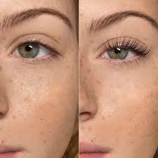 Lashella Long Eyelashes Serum Eyes