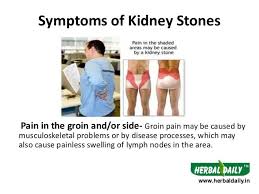 Pin On Cause Prevention Traetment Of Kidney Stones