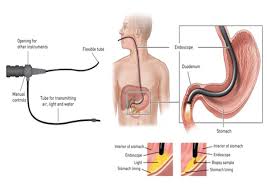 Diagnostic GI Procedures – Landmark Hospital