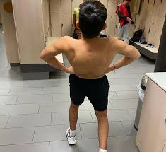 The muscles of the back that work together to support the spine, help keep the body upright and allow twist and bend in many directions. Muscle Atrophy Wikipedia