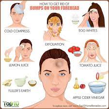 Apply it to affected areas evenly and leave for 5 minutes. Bumps On Forehead 8 Home Remedies To Reduce It Forehead Bumps Forehead Acne Pimples On Forehead