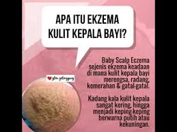 Penyebab yang kurang parah pada kulit kepala gatal meliputi pembersihan, pencucian dan pengelupasan yang tidak tepat. Hilangkan Eczema Gatal Kulit Kepala Bayi Youtube
