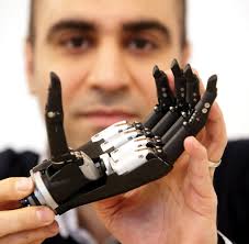 The U.K. Pushes the Boundaries of Bionics