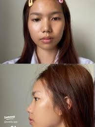 Martyrdom, younger nose!!!