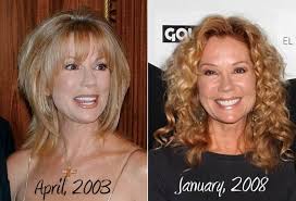 The aging population, also an increasingly constructive public perception regarding plastic surgery has been driving forces behind the . Nancy O Dell Plastic Surgery Before And After Photos Celeblens Com