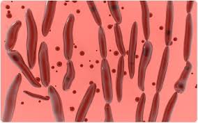 Image result for Clostridium
