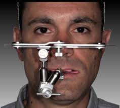 Benefits and Reasons To Complete a Diagnostic Wax-Up