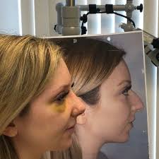 THE BEST 10 Ear Nose & Throat near LARCHMONT, NY