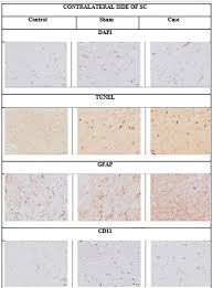 Image result for karp ln  tunel ort za