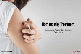 Homeopathic medicines like apis mel, sulfur, thyreoidinum, psorinum etc for treating skin allergies like hives, urticaria, red rashes. Homeopathy Treatment For Itching Allergic Reactions By Dr Pramod Sharma Lybrate
