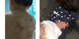 Terdapat dua kes kematian akibat penderaan dilaporkan di perancis dan satu kes di sepanyol yang menunjukkan betapa seriusnya perkara ini dan keperluan untuk ianya diberikan tumpuan. Kesan Penderaan Kanak Kanak Terhadap Perkembangan Emosi Fizikal