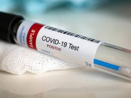 Who can get a free test. Easy Affordable Ultra Rapid Testing For Covid 19 News Cordis European Commission