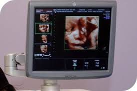 Los mejores Ginecólogos en Coyoacán y Patriotismo