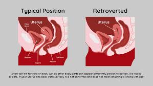 Image result for cervix position