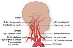 Blood is oxygenated in capillaries that flow through the alveoli of the lungs. Vasculature Of The Head Texas Heart Institute