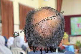 Pria tersebut datang ke kantor imigrasi untuk memperpanjang paspor yang sudah habis masa berlakunya. Bald Head Need Vitamins Gambar Pemandangan Lucu