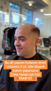 Alper Aslan Protez Saç