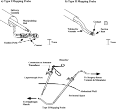 Mapping The Phrenic Nerve Motor Point The Key To A Successful Laparoscopic Diaphragm Pacing System In The First Human Series Surgery