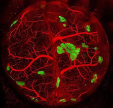 Boussingoltia basselloides, es una planta oriunda de la región del ecuador, la cual es utilizada tradicionalmente para el tratamiento de la diabetes. Fabrican Islotes Pancreaticos Capaces De Curar La Diabetes Tipo 1 En Ratones
