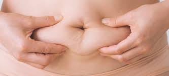 Maybe you would like to learn more about one of these? Diastasis Recti Safe Ways To Get Your Abs Back Dr Axe