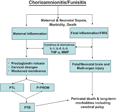 Image result for Chorioamnionitis
