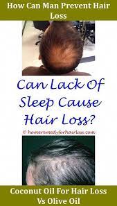 Pin On Hair Loss Stinks
