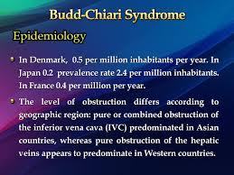 Budd Chiari Syndrome And Sinusoidal Obstruction Syndrome Ppt Download