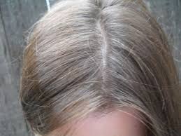How To Get Rid Of Gray Hair With Potato Skins Beauty Insider Net Grey Hair Henna Henna Hair Grey Hair Treatment