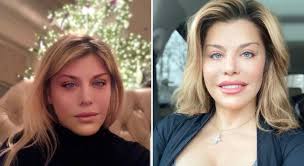 Loredana groza, criticată din nou de fani pentru ultimele apariții. Loredana Groza DÄƒ ReplicÄƒ CarcotaÈ™ilor Care Spun CÄƒ S A Operat La FaÈ›Äƒ