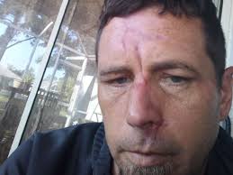 Fundraiser for Deborah White by Wesley White : Bicyclist hit @ 50mph by 2  trucks doa but survived