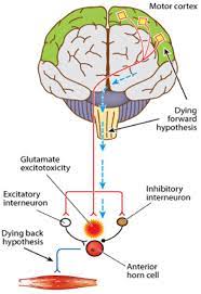 Als is characterized by a progressive degeneration of motor nerve cells in. Transcranial Magnetic Stimulation And Amyotrophic Lateral Sclerosis Pathophysiological Insights Journal Of Neurology Neurosurgery Psychiatry