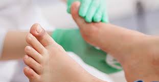 Image result for gout